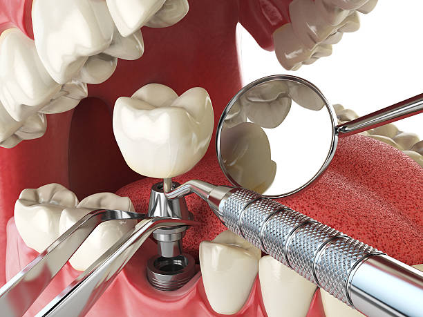 Best Walk-In Emergency Dental Services in Monson Center, MA
