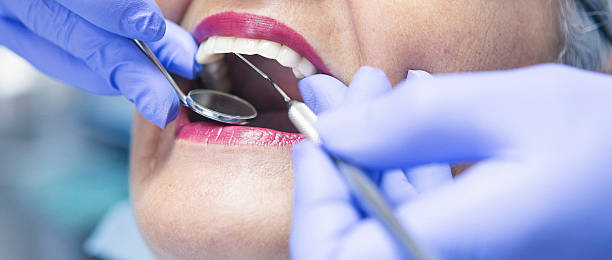 Best Emergency Cosmetic Dentistry (e.g., broken veneers) in Monson Center, MA
